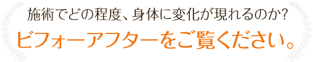 施術でどの程度、身体に変化が現れるのか？ビフォーアフターをご覧ください。